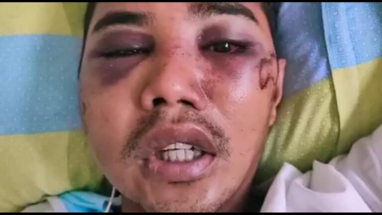 Factory worker in Cavite allegedly mauled by police over ECQ violations